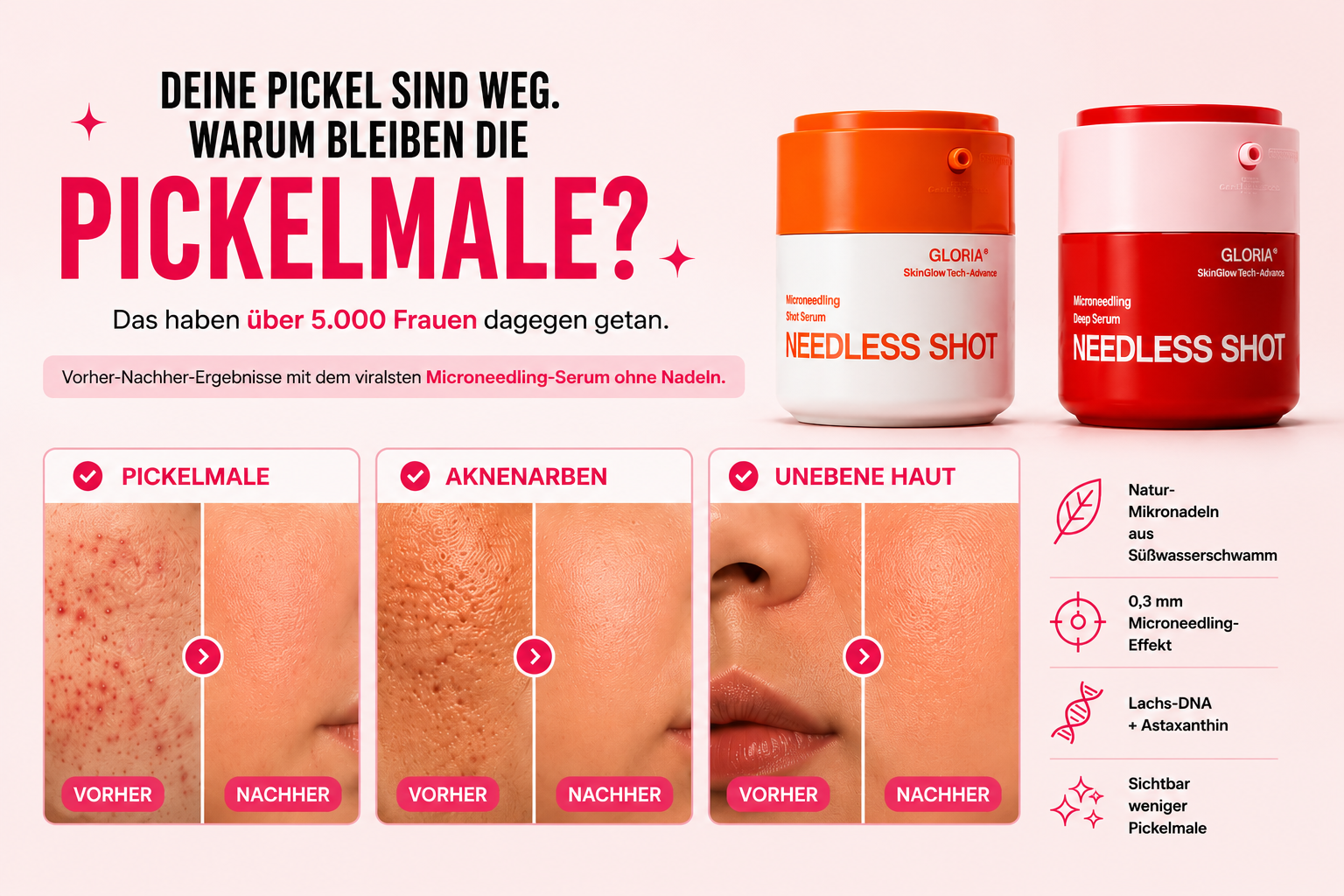 Gloria Skincare Needless Shot für Pickelmale, Aknenarben und unebene Haut